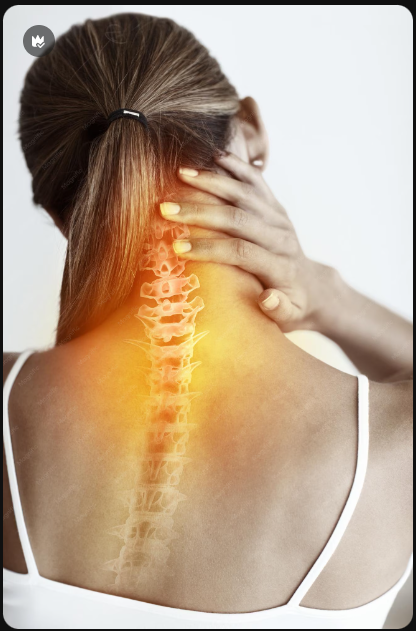 Ilustración de un esguince cervical